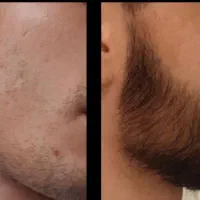 قطعا ریش نشونه مرونگیه