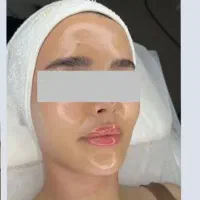 پاکسازی پوست با4دستگاهو 4ماده فقط 500