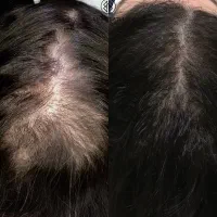 اگه استفاده نکنی سرت کلاه رفته