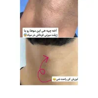 لیزر موهای زائد لیزر آقایان لیزر بانوان آموزش|خدمات آموزشی|اصفهان, بوستان آینه خانه|دیوار