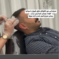 مزوتراپی مو ،برای خانمهاواقایان در کلینیک دی
