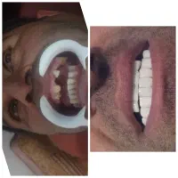 ترمیم و زیبایی|خدمات آرایشگری و زیبایی|یاسوج, |دیوار