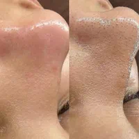 پاکسازی تخصصی و فیشال vip