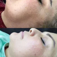پاکسازی تخصصی پوست صورت|خدمات آرایشگری و زیبایی|اصفهان, فرح آباد|دیوار