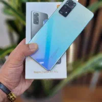 redmi not11 poro ردمی