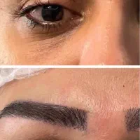 کاشت مو و ابرو اقساطی|خدمات زیبایی و سلامت|کرج, مهرویلا جنوبی|دیوار