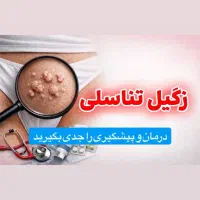 درمان پزشکی *زگیل تناسلی*اولین بار در اصفهان