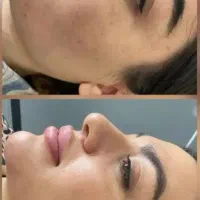 فشیال و پاکسازی پوست و خدمات درمانی جشنواره تخفیف%|خدمات زیبایی و سلامت|مشهد, استاد یوسفی (شهرک غرب)|دیوار