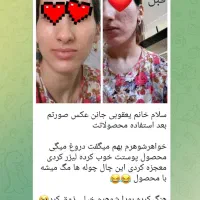 پوستت هلوی با تکسو|خدمات آرایشگری و زیبایی|کرمان, |دیوار