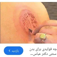 حجامت بادکش