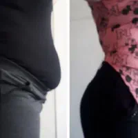 لاغری موضعی بادستگاه،مزوتراپی چربی سوز،رژیم درمانی|خدمات آرایشگری و زیبایی|زنجان, |دیوار