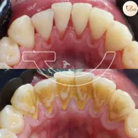 دندان پزشکی|خدمات آرایشگری و زیبایی|قم, نوقطار|دیوار