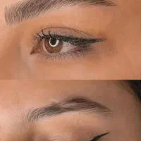 میکرو و احیای تتو های تیره و ذغال در یک جلسه