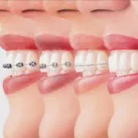 ارتودنسی|خدمات آرایشگری و زیبایی|شیراز, کیان آباد|دیوار