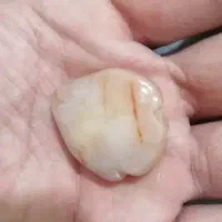 سنگ قیمتی