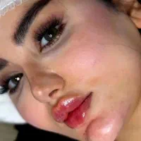 ژل لب بوتاکس نخ آموزش بینی عروسکی مدل رایگان|خدمات زیبایی و سلامت|کرج, گلشهر|دیوار