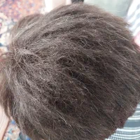 ترمیم پروتز مو با موی پروسس