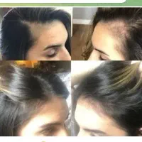 بیا کمکت کنم ریزش موهات قطع بشه