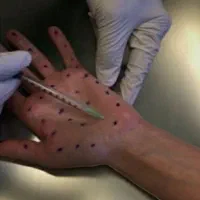 بوتاکس ۸۰۰ زیربغل میگرن فیلر ژل مدلینگ باسن پزشک|خدمات زیبایی و سلامت|کرج, برغان|دیوار