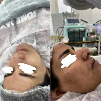 نیازمند مدل فیشیال تخصصی