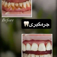 تخفیف خدمات دندانپزشکی و شرایط پرداخت اقساط|خدمات آرایشگری و زیبایی|رشت, گلسار|دیوار