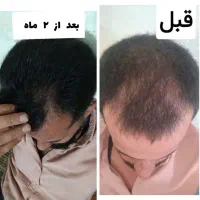 سالم بودن موهاتون الویته