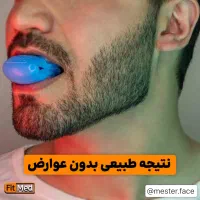 زاویه فک ساز بهترین کیفیت بازار|آرایشی، بهداشتی، درمانی|تهران, اقدسیه|دیوار