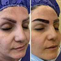 جشمواره کاشت دائمی ابرو با اقساط ویژه