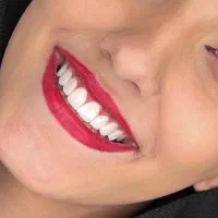 مرکز ایمپلنت و کامپوزیت با شرایط اقساط