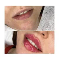ژل بوتاکس، مزو، لیزر، لاغری کلینیک پزشکان فرهنگیان