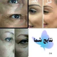 اکرم م طوب کننده دستوصورت ماسک مو قبل وبعد از حمام