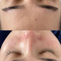 مرکز زیبایی با بروزترین دستگاه های روز دنیا|خدمات آرایشگری و زیبایی|ماهدشت, |دیوار