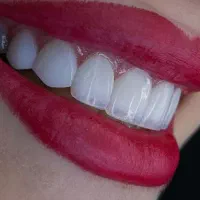 خدمات دندان پزشکی/شرایط اقساطی/۱۲ ماهه