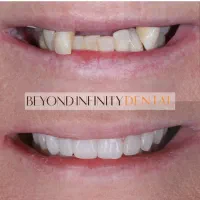 مرکزفوق تخصصی ایمپلنت دیجیتال/فوری/سبک کاخ لبخند