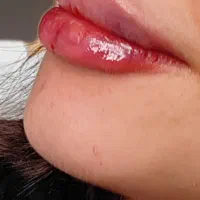 ژل لب با شرایط استثنایی (ویژه مدل)