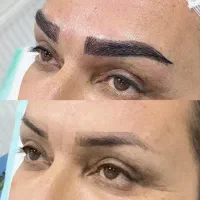 پذیرش مدل کاشت ابرو ، فرصت بی تکرار