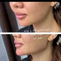 زیبایی صورت و بدن|خدمات آرایشگری و زیبایی|اهواز, نادری|دیوار