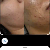 پاک سازی صورت