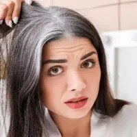 رفع سفیدی مو