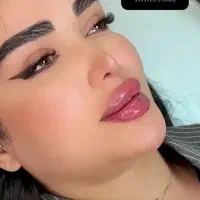 ژل لب و فول فیس ۳۷۰هزار تومان توسط پزشک کلینیک