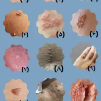 درمانتو شروع کن