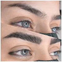 فیبروز میکروبلیدینگ ابرو با تخفیف 80 درصد