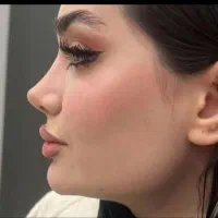 عمل جراحی بینی و بدن ..