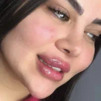 جدیدترین دستگاه لیزر مو های زائد ‌‌و فیشال دراهواز|خدمات آرایشگری و زیبایی|اهواز, گلستان|دیوار