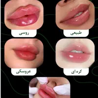 جشنواره یلدایی ژل بوتاکس نخ زاویه اراف فول فیس