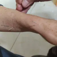 حجامت،زالودرمانی،اصلاح ستون فقرات ودیسک کمر|خدمات آرایشگری و زیبایی|خرم‌آباد, |دیوار
