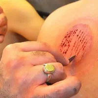 درمان درد سیاتیک و دیسک کمر|آرایشی، بهداشتی، درمانی|هامون, |دیوار