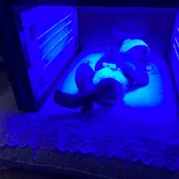 کرایه دستگاه زردی نوزاد/فتوتراپی(کل مناطق)