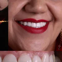 دندانپزشکی عصب کشی ترمیم کامپوزیت مناسب ترین قیمت|خدمات آرایشگری و زیبایی|مشهد, ده دی|دیوار