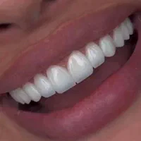 کلینیک دندانپزشکی بزرگمهر با تعرفه دولتی|خدمات آرایشگری و زیبایی|اهواز, شهرک حفاری|دیوار